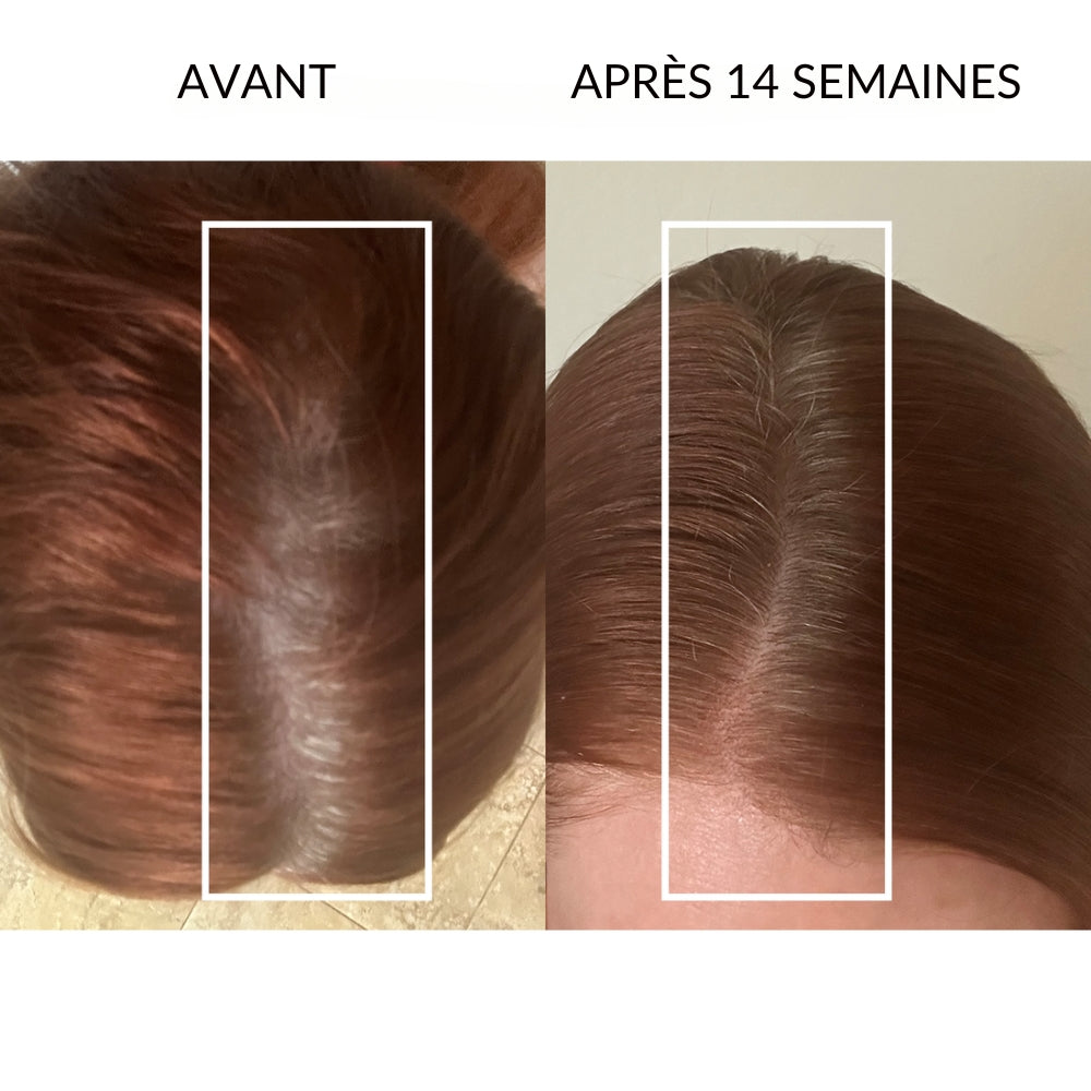 Casquette à lumière rouge Lumiglo® Pro