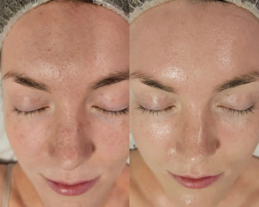 Teint terne, que faire ? 7 solutions efficaces pour retrouver un éclat naturel